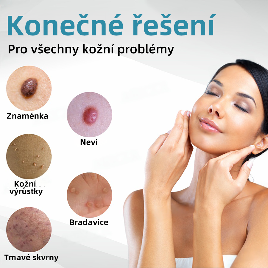 Bikenda® Neinvazivní laserový pero na odstraňování bradavic a molů Superior🔥