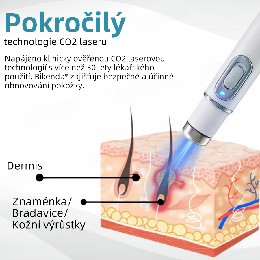 Bikenda® Neinvazivní laserový pero na odstraňování bradavic a molů Superior🔥