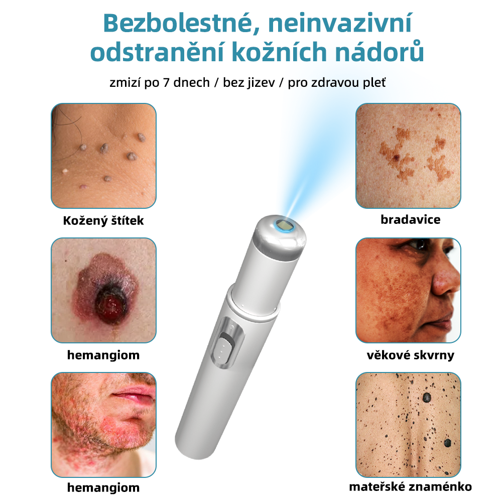 KIDSNEED® Neinvazivní laserové pero na odstranění bradavic a znamének - silně Recommended by the Czech Dermatovenerological Society (ČDS)🔥