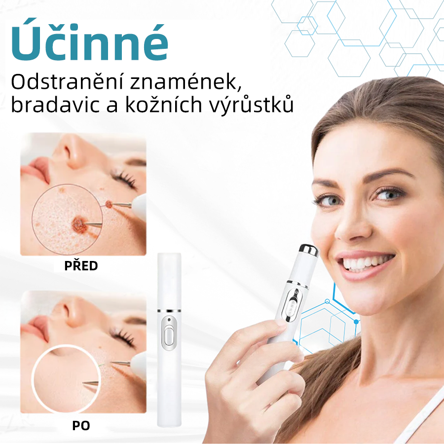 Bikenda® Neinvazivní laserový pero na odstraňování bradavic a molů Superior🔥