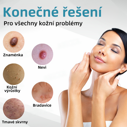 Bikenda® Neinvazivní laserový pero na odstraňování bradavic a molů Superior🔥