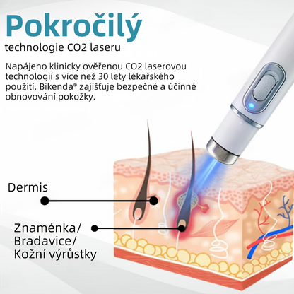 Bikenda® Neinvazivní laserový pero na odstraňování bradavic a molů Superior🔥